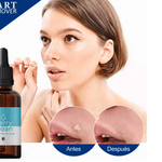 Elimina Verrugas con Verryclean+Envio Gratis